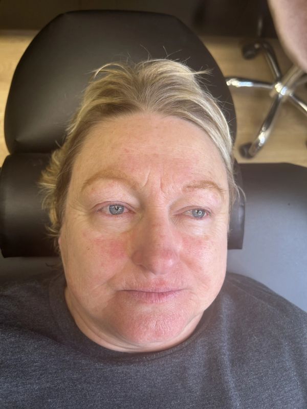 After — Faded blonde brows redefined and tinted into a soft, natural frame.