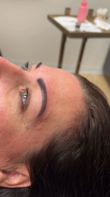 After — Sparse, uneven brows reshaped with microblading for hair-like definition.