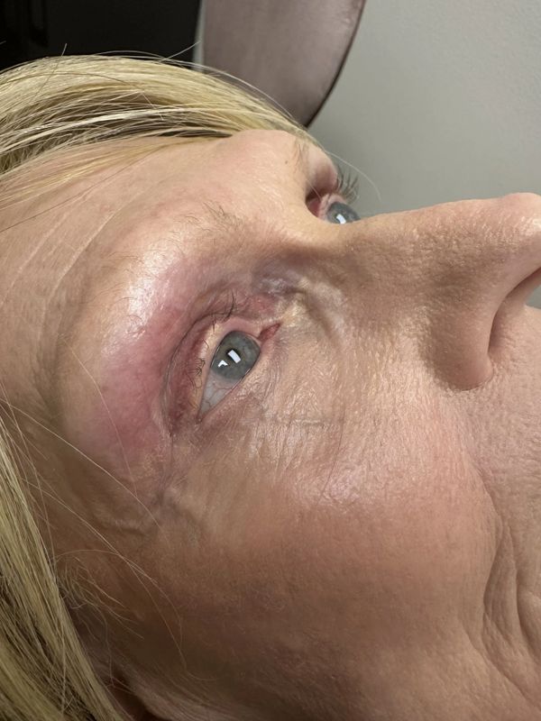 Before — Bare, sparse natural lashes transformed with custom extensions for soft, flattering definition.